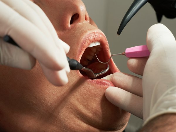 Dents de sagesse : extraction et récupération post-opératoire sans stress